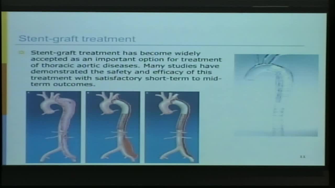 Flow structures and wall shear stress patterns in the thoracic aorta Thumbnail