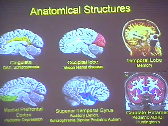 Paths Towards Understanding the Shapes of the Whole Brain Thumbnail