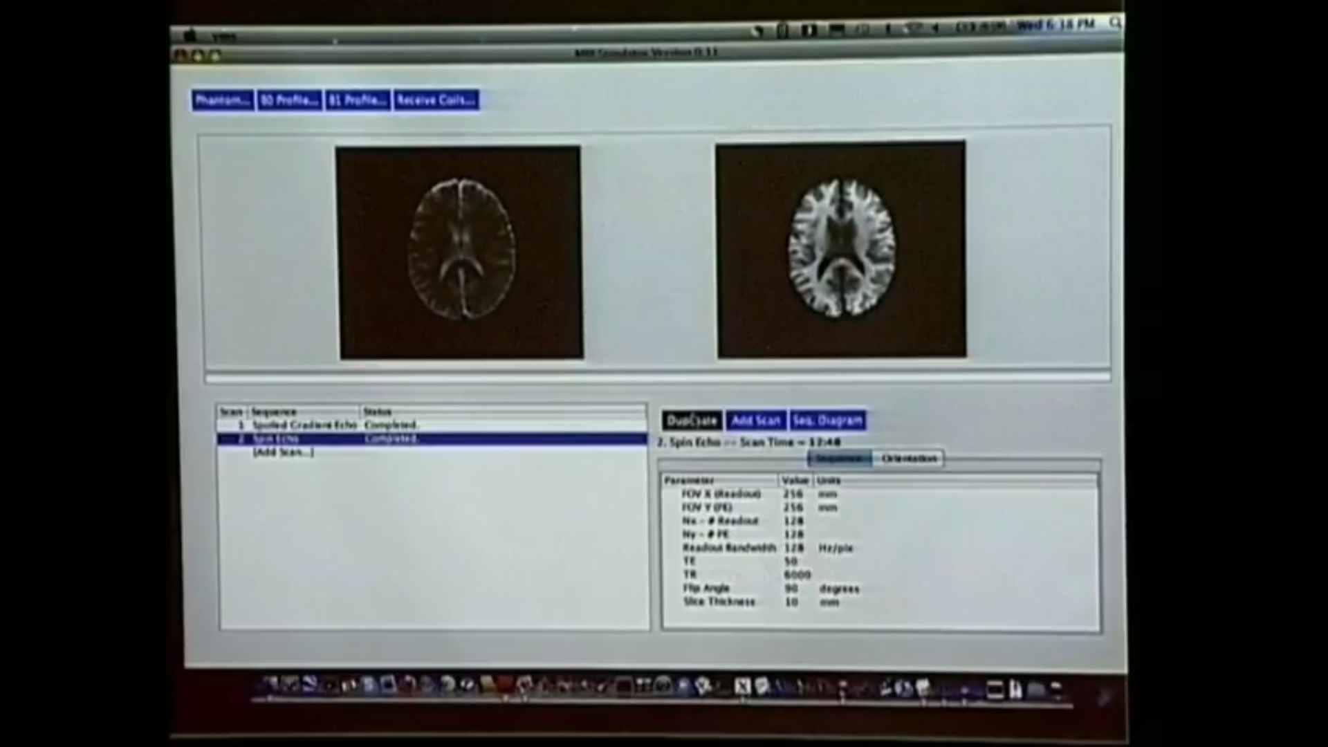 An Introduction to Magnetic Resonance Imaging III Thumbnail