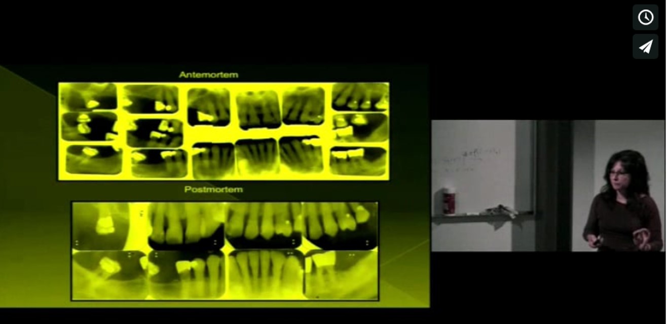 Forensics Fall Course: Mary & Peter Bush - Statistics and Applied Mathematical Science Aspects of Forensic Science – Part 1; Bitemarks Thumbnail