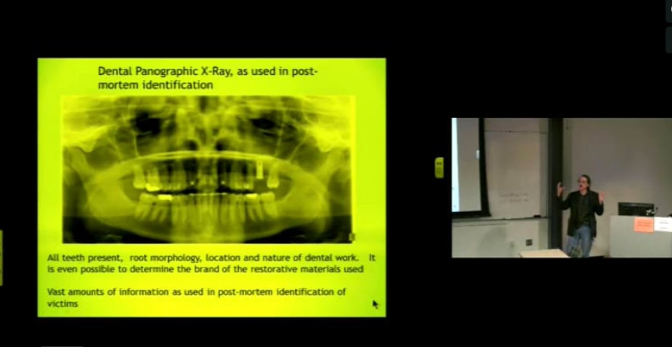 Forensics Fall Course: Arun Ross - Statistics and Applied Mathematical Science Aspects of Forensic Science – Part 1; Approaches to Uncertainty in Pattern Matching: Issues in Forensic Bitemark Comparisons Thumbnail